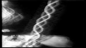 A black and white image of a x - ray.